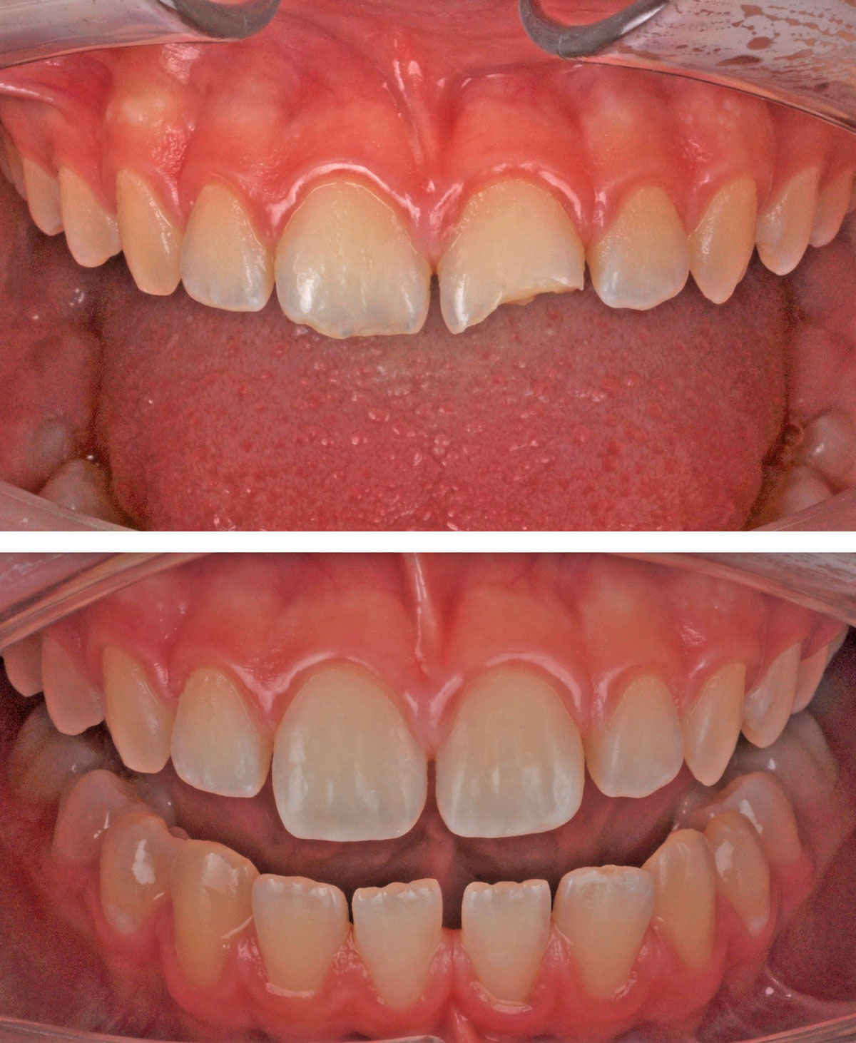 estetica-trauma-pre